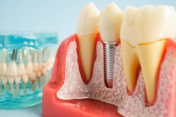 Best Tooth Extraction  in Delta, UT